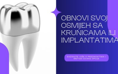 Mostovi ili implantati? Pitanje je sad…